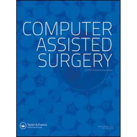 Computer Assisted Surgery Computer Assisted Surgery